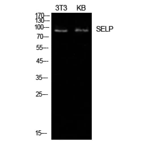 IHC-plus™ SELP / P-Selectin / CD62P Antibody (81-130 aa, N-terminal)
