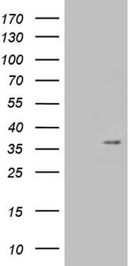 TNFSF5IP1 / CLAST3 Antibody (clone OTI2F10)