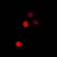 ATOH1 / MATH-1 Antibody
