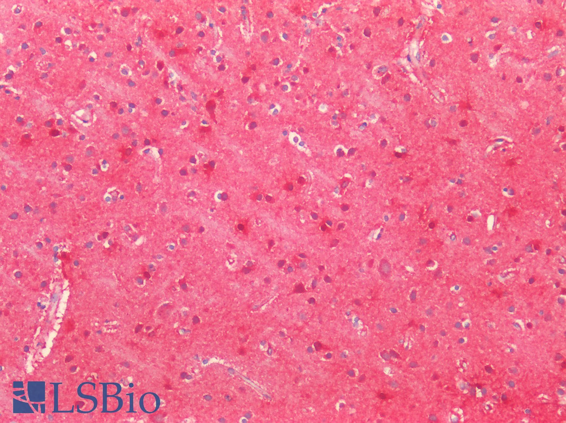 PathPlus™ SOD2 / Mn SOD Antibody (aa77-91)
