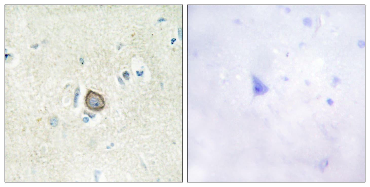 CELSR3 Antibody (aa91-140)