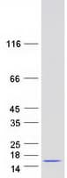 Human AAMDC Protein (Recombinant Myc-DDK (Flag))