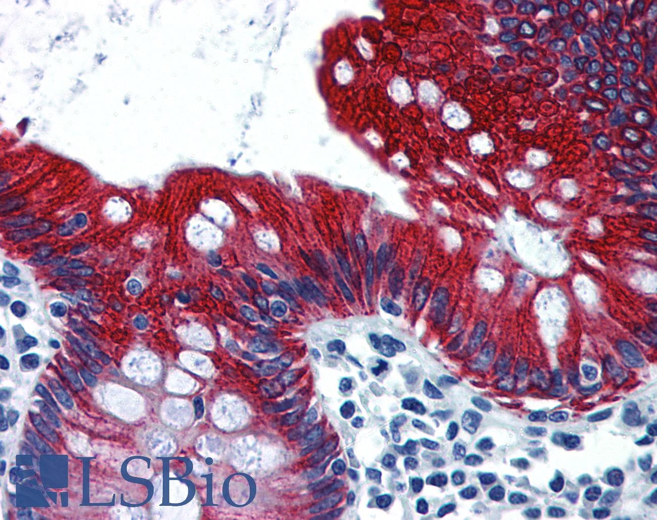 IHC-plus™ KRT19 / CK19 / Cytokeratin 19 Antibody (aa231-280)