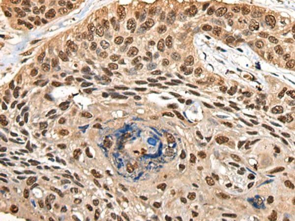 Polyclonal Rabbit anti-Human CCDC112 / MBC1 Antibody (IHC)