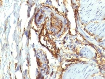 CD34 Antibody (N-Terminus, clone QBEnd/10 + HPCA1/763)