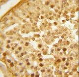 BAHD1 Antibody (aa750-777)