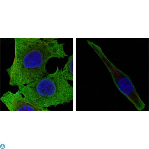 SOD1 / Cu-Zn SOD Antibody