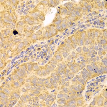 Polyclonal Rabbit anti-Human CD121b / IL1R2 Antibody (IHC, WB)