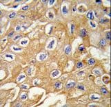 Polyclonal Rabbit anti-Human RIPK3 / RIP3 Antibody (aa61-91, IHC, WB)