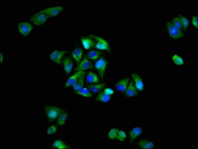 GRIK1 / GLUR5 Antibody