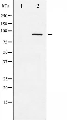ADD1 / Adducin Alpha Antibody (phospho-Ser726)