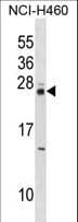 MOB4 / PHOCN Antibody (aa1-30)