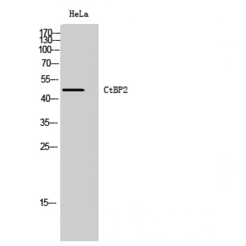 CTBP2 Antibody (370-450 aa, C-terminal)