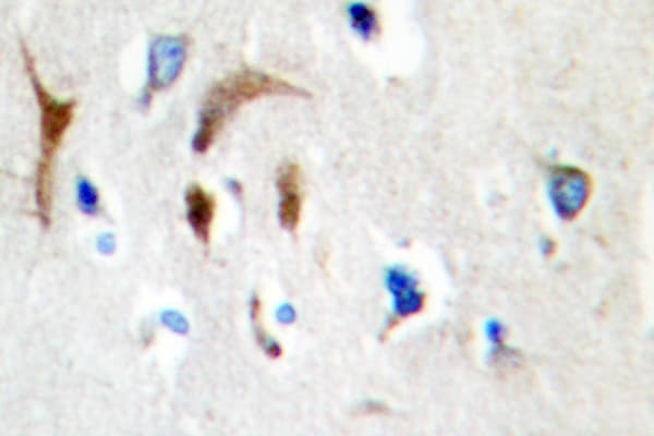 HBP1 Antibody (Leu468)