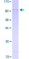 Human KRT9 / CK9 / Cytokeratin 9 Protein (Recombinant GST)