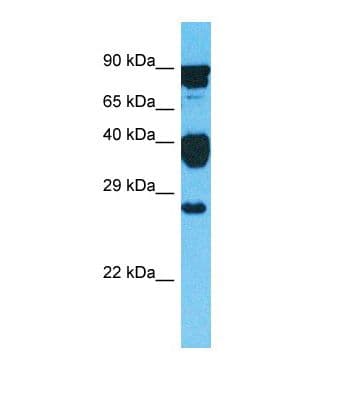 Polyclonal Rabbit anti-Human GLIPR1L2 Antibody (C-Terminus, WB)