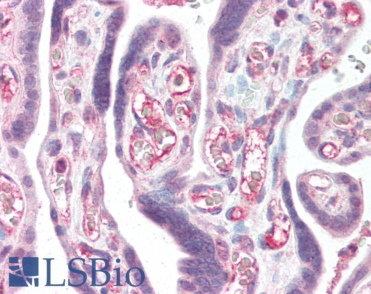 IHC-plus™ Polyclonal Rabbit anti-Human CFLAR / FLIP Antibody (IHC, IF, WB)