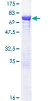 Human TCP11 Protein (Recombinant GST)