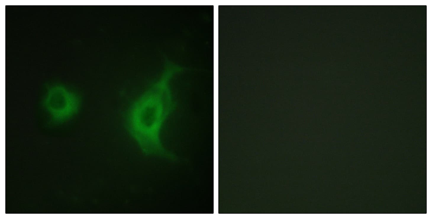Polyclonal Rabbit anti-Human RAB6KIFL / KIF20A Antibody (aa501-550, IHC, IF, WB)