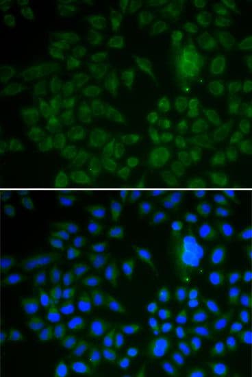 Polyclonal Rabbit anti-Human LRP1 / CD91 Antibody (IF)