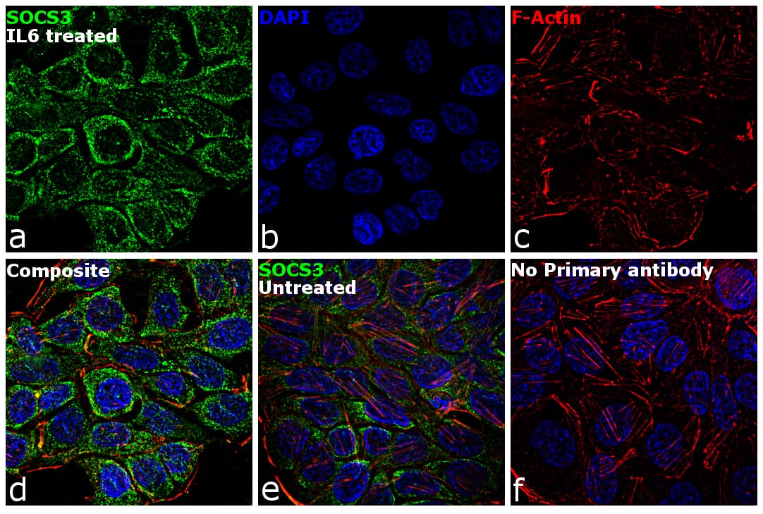 Monoclonal Mouse anti-Human SOCS3 Antibody (clone SO1, IF, WB)