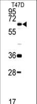 Polyclonal Rabbit anti-Human DDX5 Antibody (aa491-518, IHC, WB)