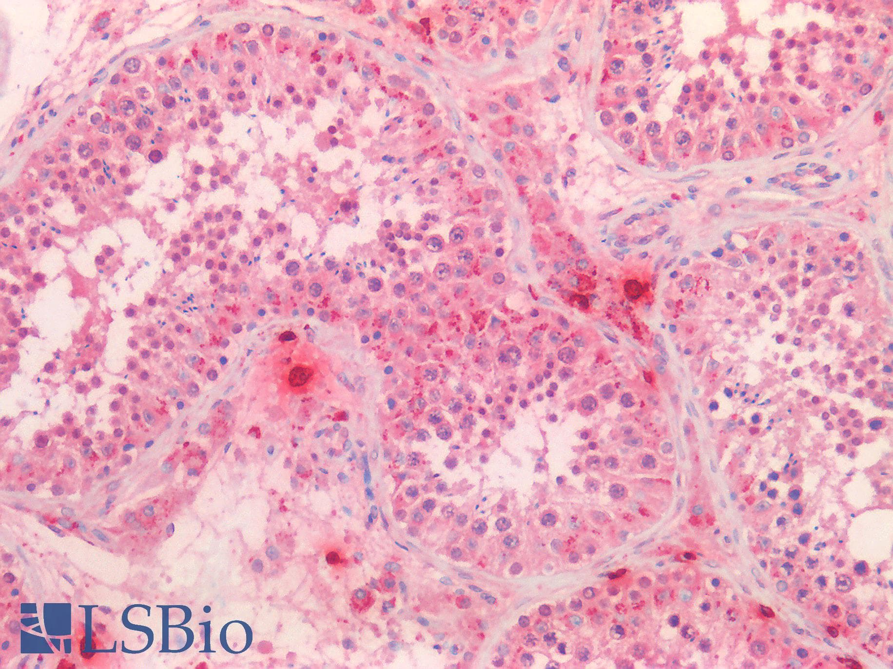Monoclonal Mouse anti-Human TPSAB1 / Mast Cell Tryptase Antibody (clone C10, IHC, WB)