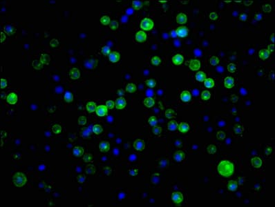 Recombinant Monoclonal Rabbit anti-Human CR2 / CD21 Antibody (IHC, IF, WB)