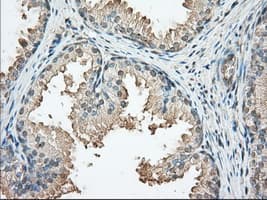 PRKAR2A Antibody (clone OTI5F1)