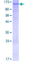 Human C16orf62 Protein (Recombinant GST)