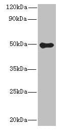 IHC-plus™ GSDMB / Gasdermin-Like Antibody