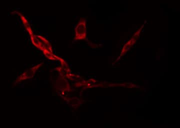 Polyclonal Rabbit anti-Human RPS6KC1 Antibody (IF, WB)