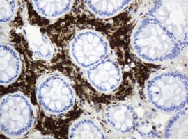TP / Thymidine Phosphorylase Antibody (clone OTI5B11)
