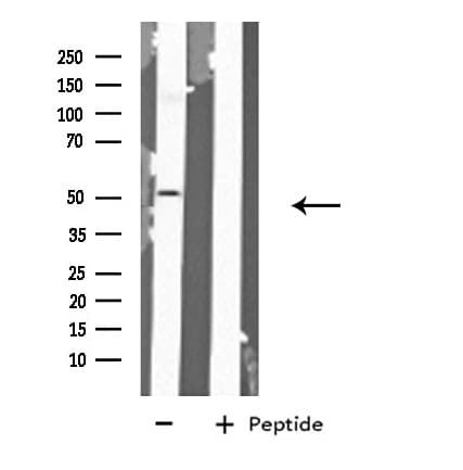 GABRA6 Antibody