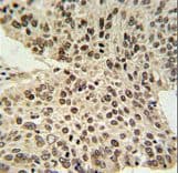 HIST1H2AL Antibody (aa103-130)