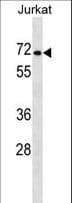 Polyclonal Rabbit anti-Human PRODH2 / HSPOX1 Antibody (aa172-200, WB)