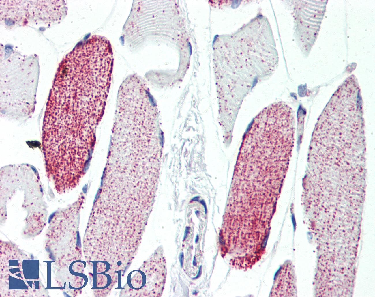 IHC-plus™ ACO2 / Aconitase 2 Antibody (aa438-467)