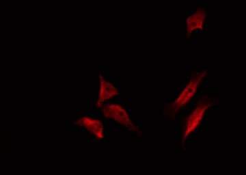 HSPA9 / Mortalin / GRP75 Antibody