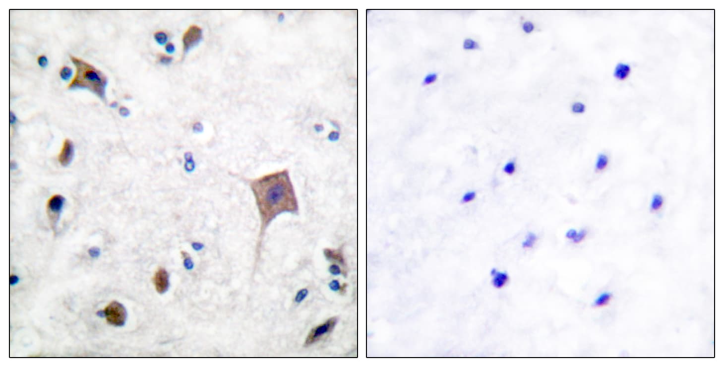 PTK2B / PYK2 Antibody (aa546-595)