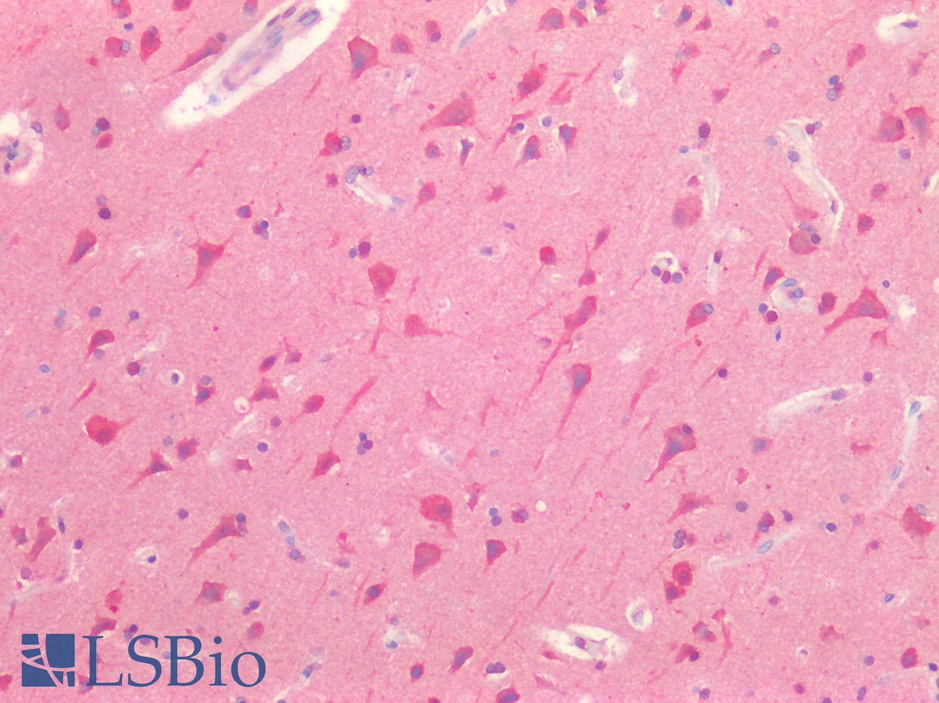 IHC-plus™ TH / Tyrosine Hydroxylase Antibody