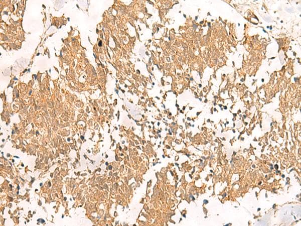 MTHFD2L Antibody