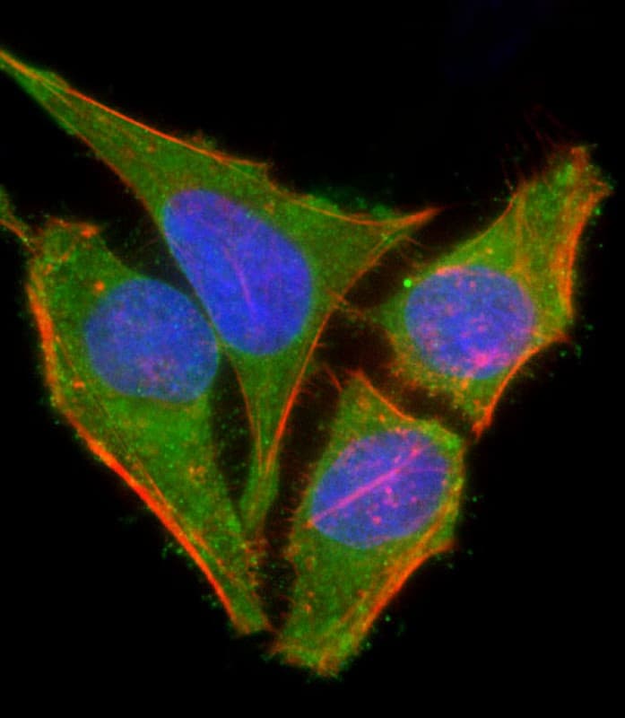 MAP3K7 / TAK1 Antibody (Ser439)
