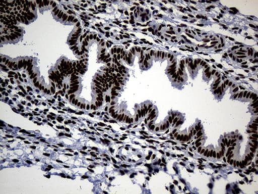Monoclonal Mouse anti-Human TP53BP1 / 53BP1 Antibody (clone OTI6D9, aa1-300, IHC, WB)