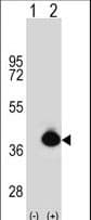 POLDIP2 / PDIP38 Antibody (aa320-349)
