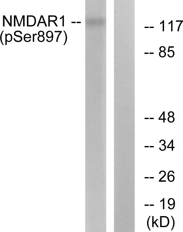 GRIN1 / NMDAR1 Antibody (phospho-Ser897)
