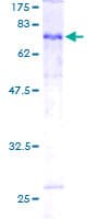 Human TUBE1 / Tubulin Epsilon Protein (Recombinant GST)