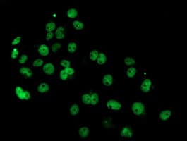 IHC-plus™ PDE4B Antibody (clone 1D12)