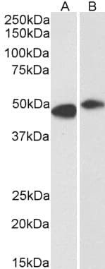 IHC-plus™ Polyclonal Goat anti-Human FBXL2 Antibody (aa2-14, IHC, WB)