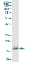 CD59 Antibody (clone 3G6)