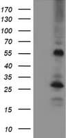 MEF2C Antibody (clone OTI1D1)